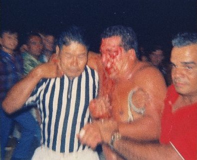 Jim Hady a bloody mess